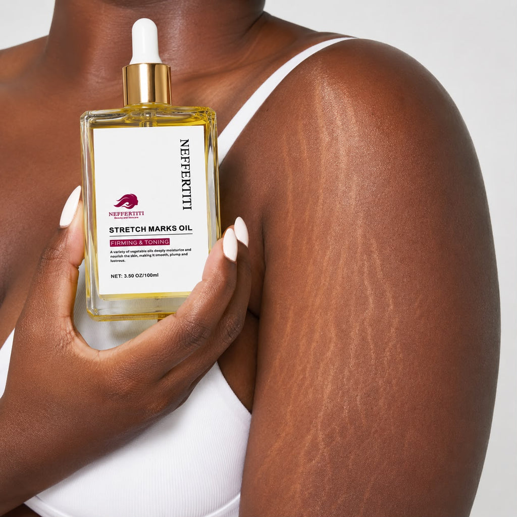 Stretch Marks Oil